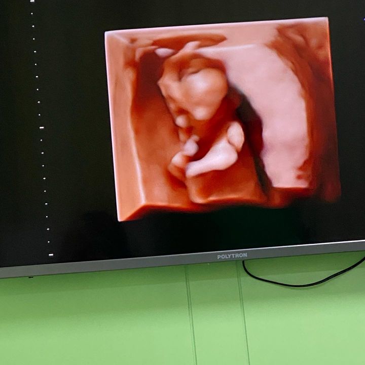 586E20A4-03A3-43AE-814F-50A93E173301